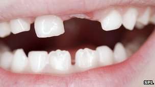 #Science: New teeth grown from urine