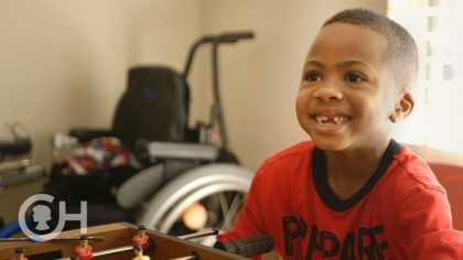 First Bilateral Hand Transplant in a Child: Zion's Story