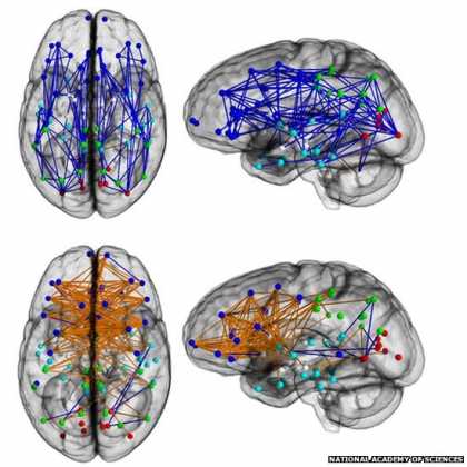 Men and women's #brains are 'wired differently'