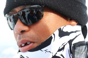 Tiger Woods' Missing Tooth Explained