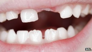 #Science: New teeth grown from urine