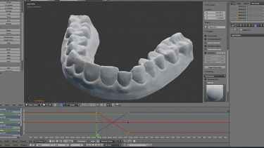 College student 3D prints his own braces